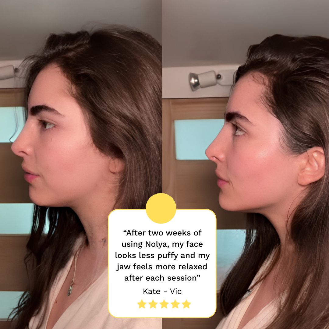 Facial Sculpting Device